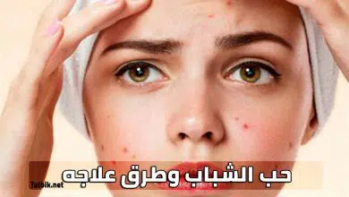 حب الشباب